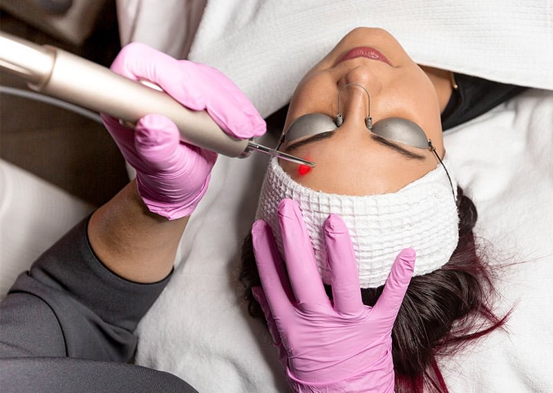 Esthétique Obella - Laser médical Fotona XP Esthétique Obella - Laser médical Fotona XP