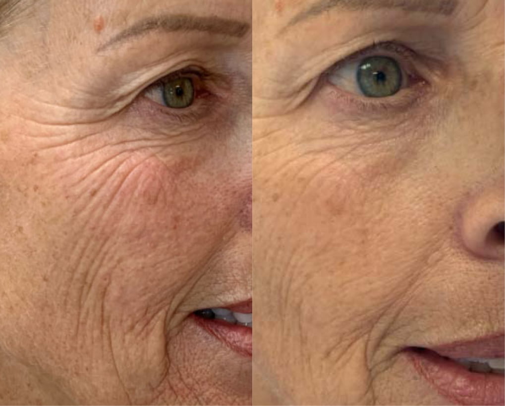 RD Cosmetics avant-après