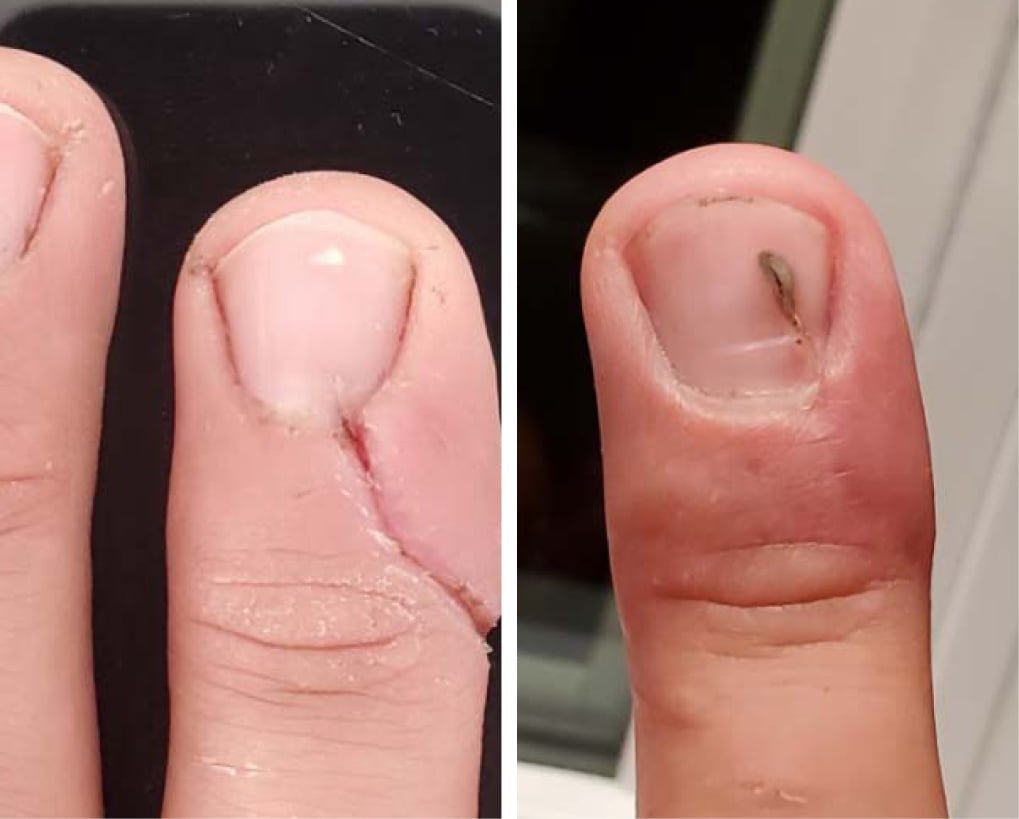RD Cosmetics avant-après
