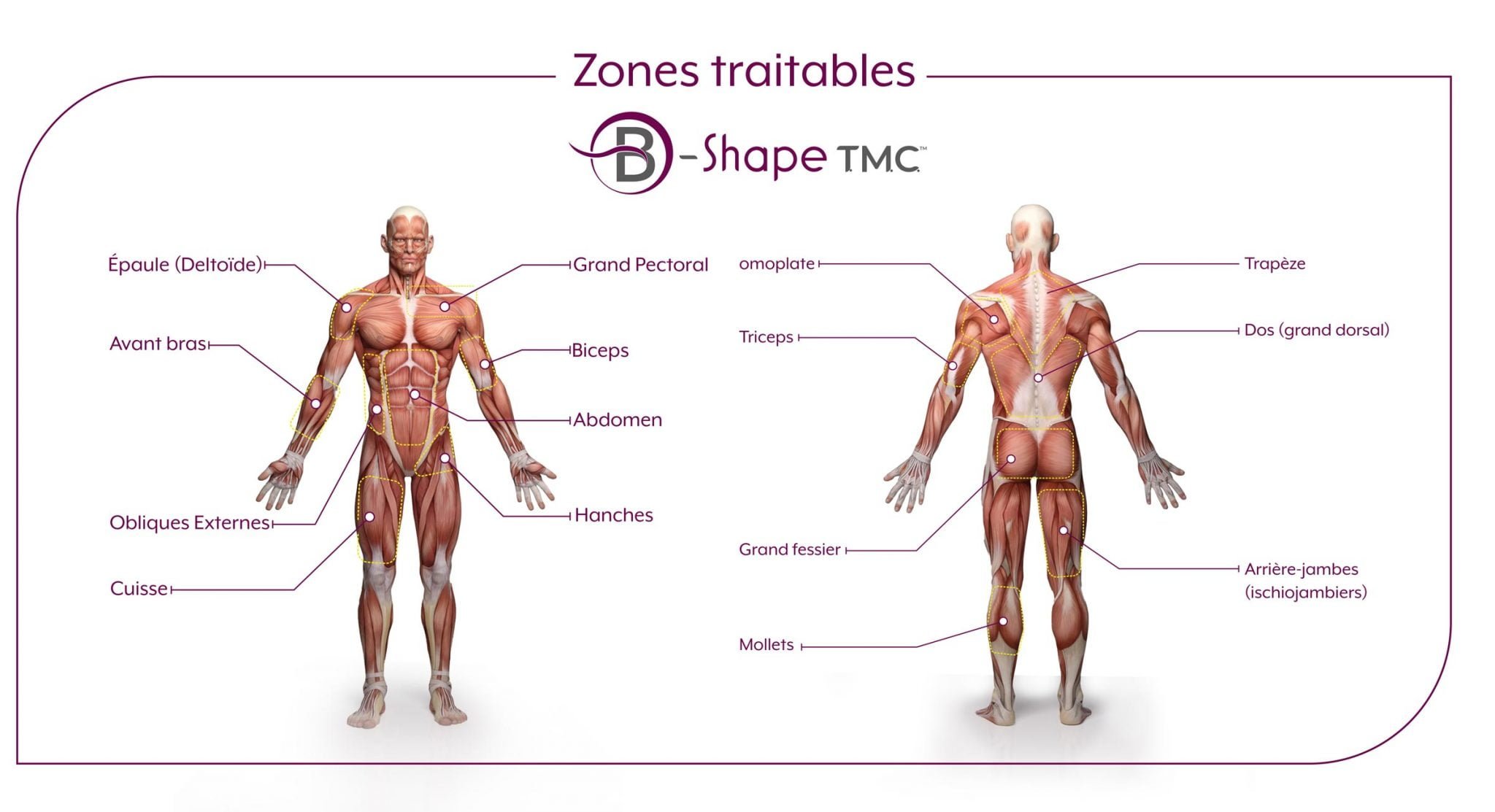 Zones traitables par B-Shape TMC Zones traitables par B-Shape TMC