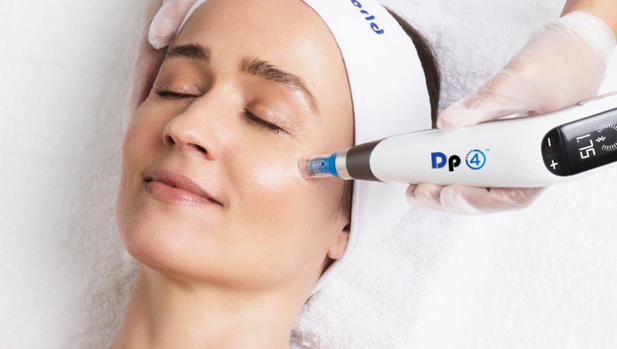Microaiguillage DP4