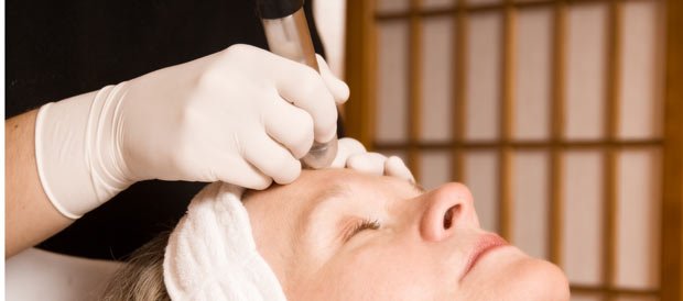 microdermabrasion